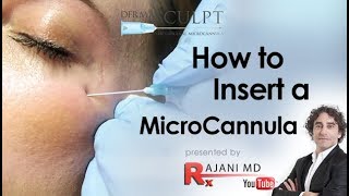 How to Insert the MicroCannulaDermal FillersDr Rajani [upl. by Amasa]