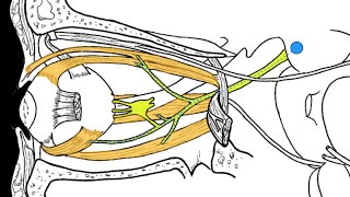 Treatment for Trigeminal Neuralgia UCSF Neurosurgery [upl. by Nyleak103]