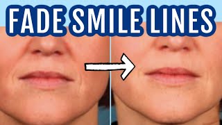 12 ways to fade smile lines nasolabial folds Dr Dray [upl. by Bevers974]