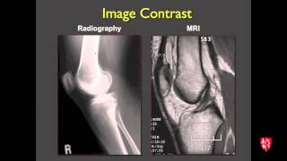 Medical Student Lecture Introduction to Musculoskeletal Imaging [upl. by Eanahc]