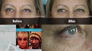 Instantly Ageless COMPLETE Review  Demo [upl. by Eitirahc]