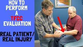 How to Perform a TFCC EvaluationReal patient real injury [upl. by Ittam587]