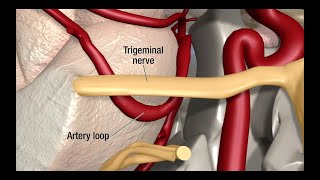 Neurology  Glossopharyngeal Nerve Cranial Nerve IX [upl. by Macdougall]